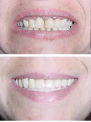 dentureba.jpg